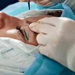 Blepharoplasty