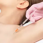 Botox Underarms