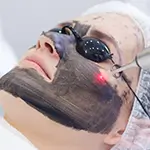 Carbon Laser