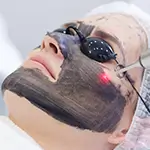Carbon Laser