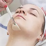 Chemical Peel