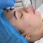 Lipolysis