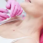 Neck Lift