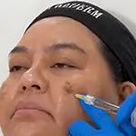 Xelarederm