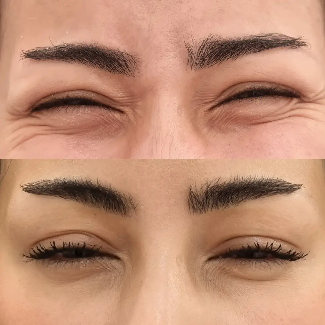 botox dr sara (1)