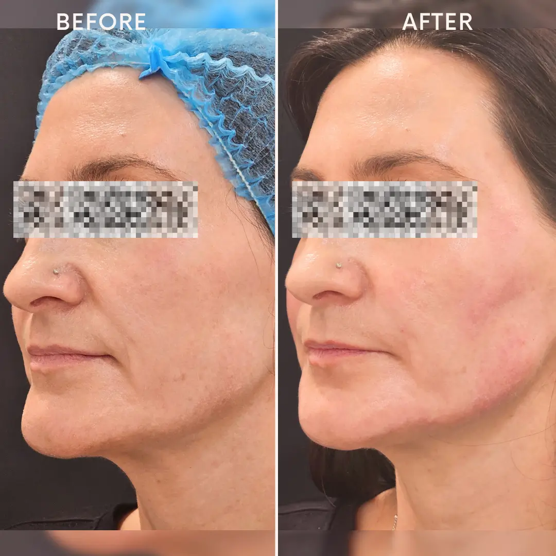 Face Enhancement1