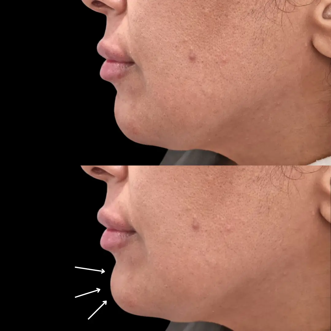 Face Enhancement3