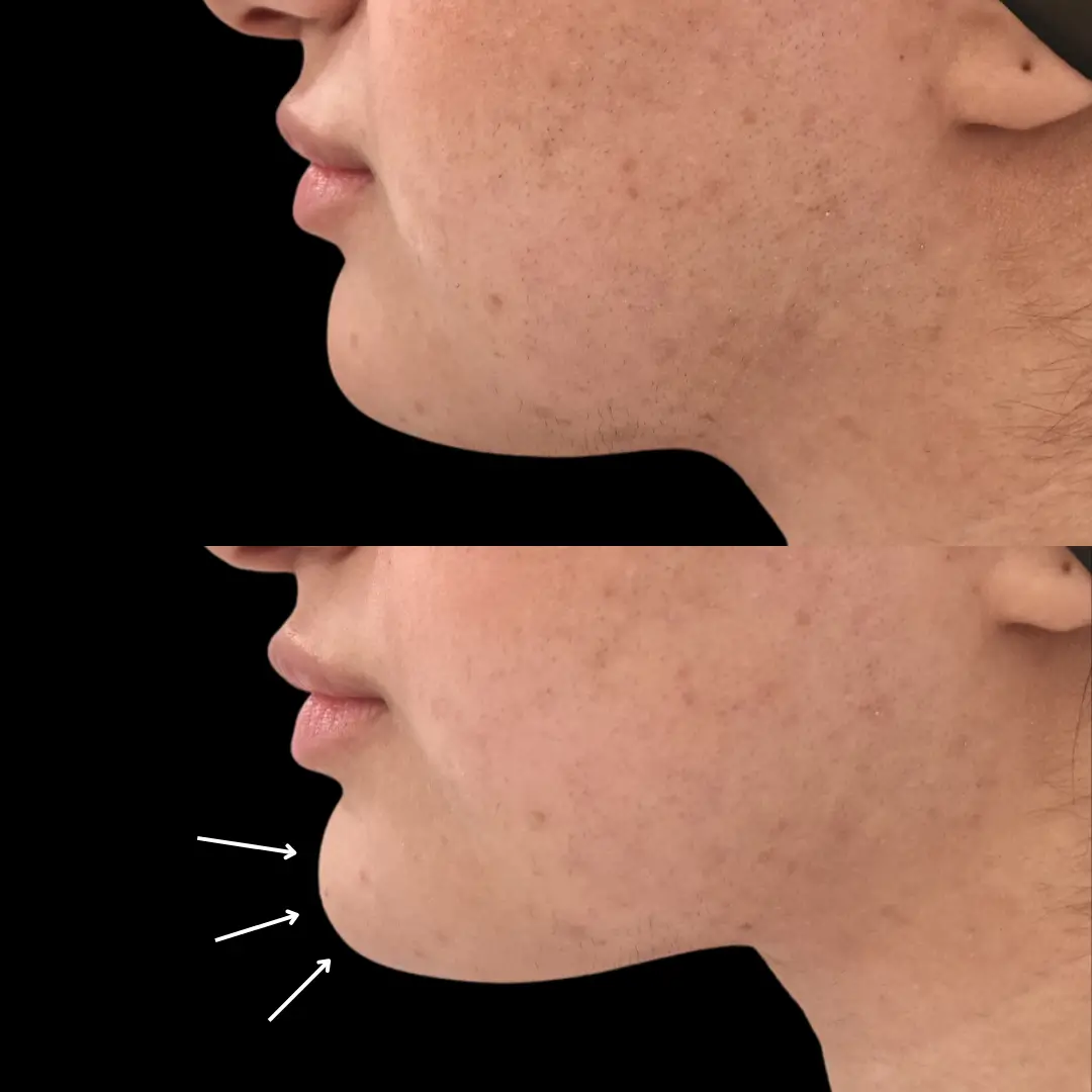Face Enhancement4