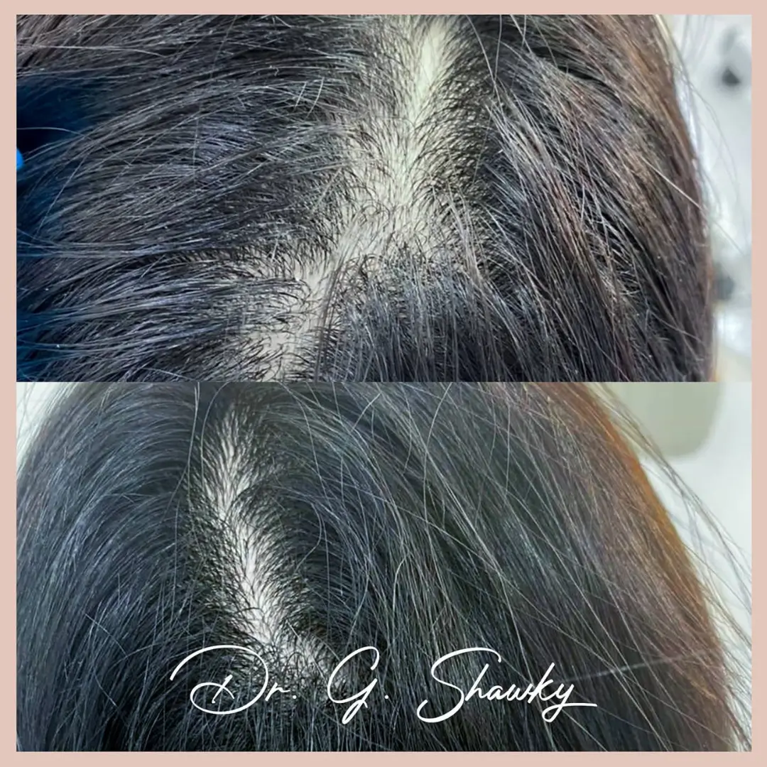 hair2
