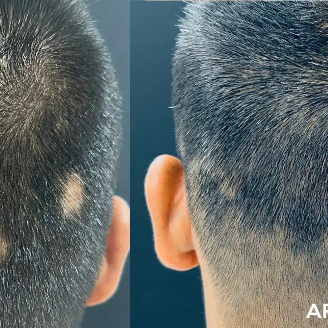 hair3